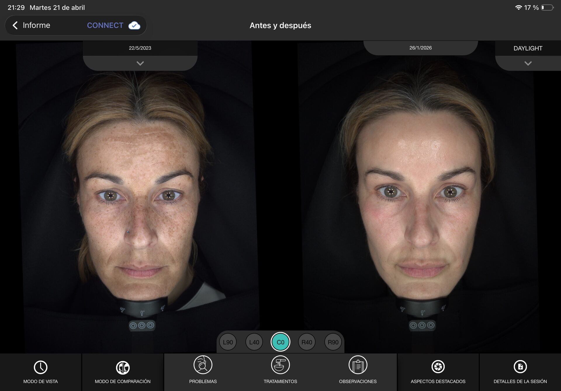 Skin Longevity treatment