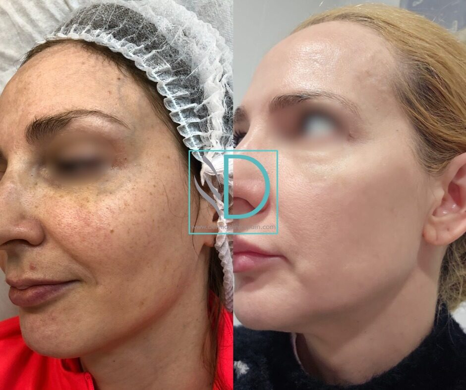 Skin Longevity patient