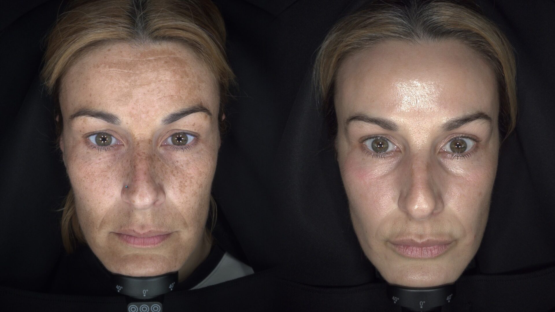 Skin Longevity result
