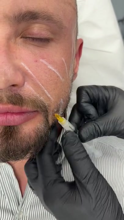Gold Collagen Protocol 2